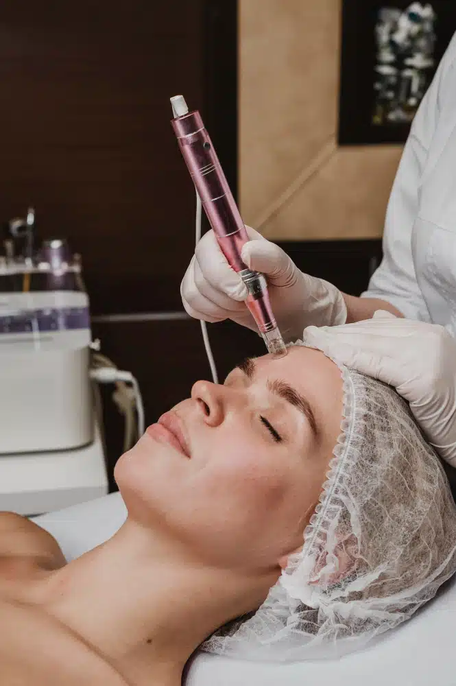 Crystal - Free Micro-dermabrasion Boca Raton