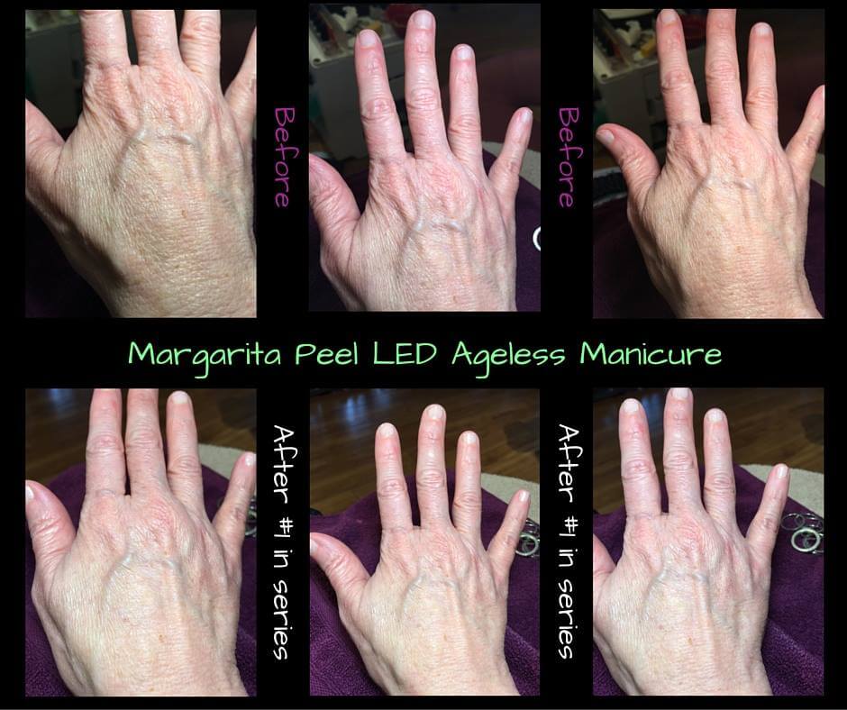 boca-raton-manicure-ageless-hands-skin-apeel