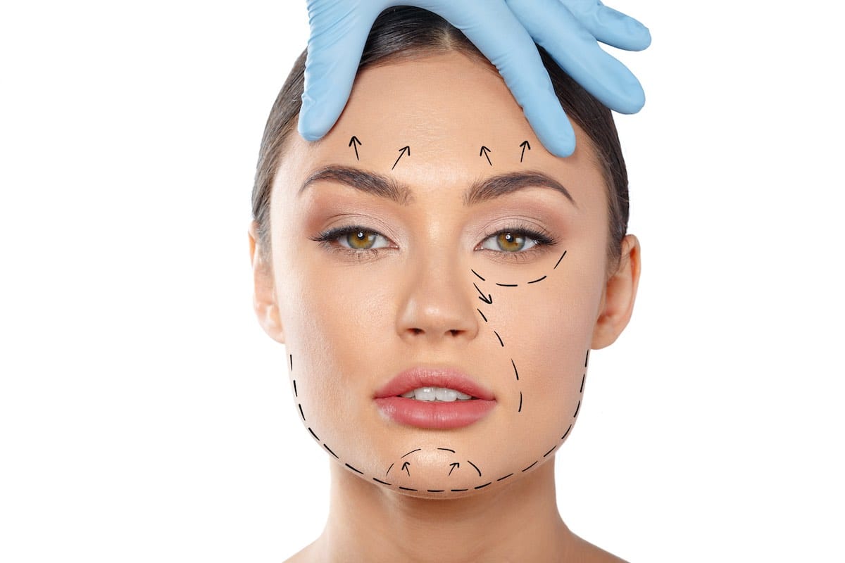 Face Lift Without Surgery