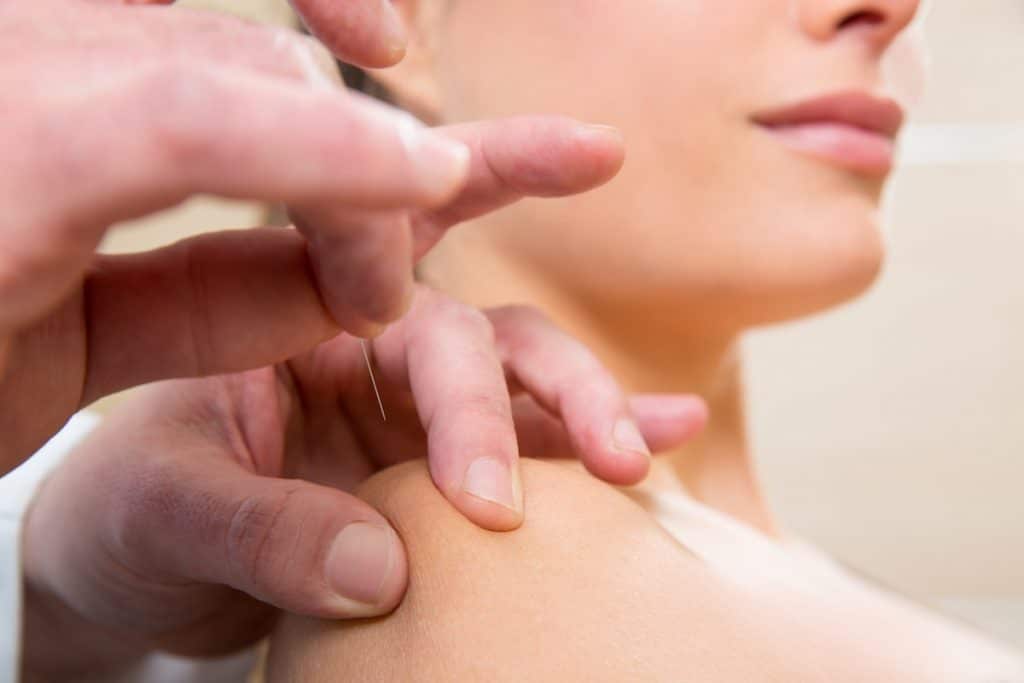 Acupuncture for stress relief benefits