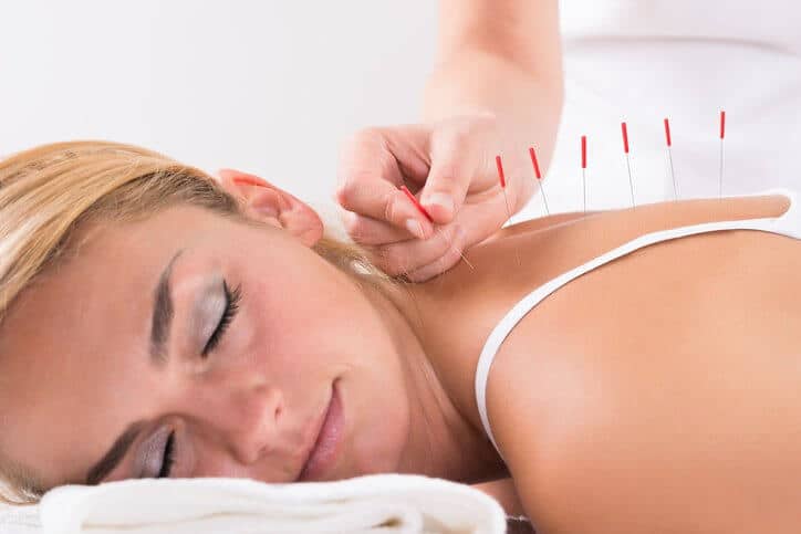 The Acupuncture Benefits For Stress – Symptoms and Treatments