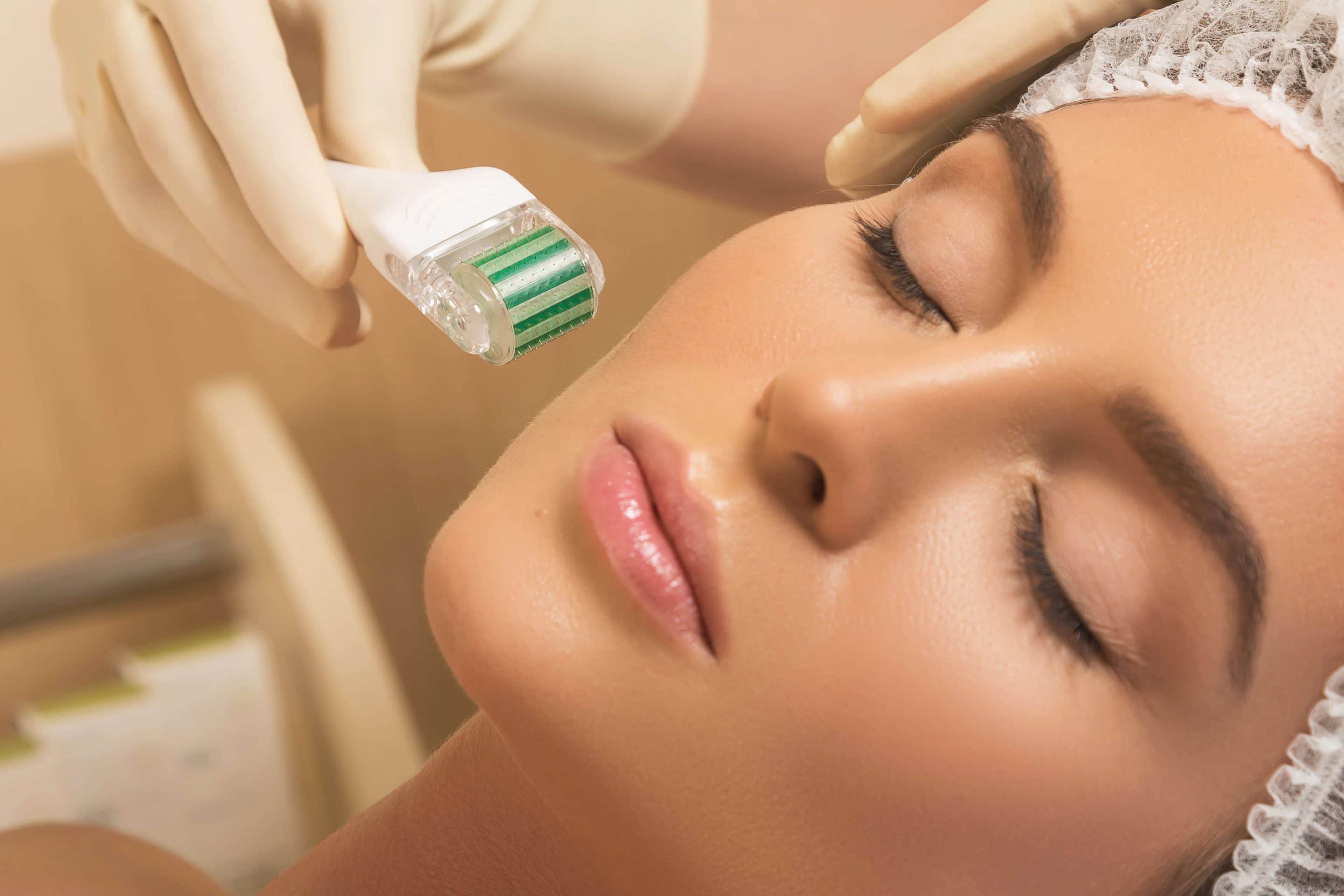 Microneedling Near Me – Benefits, Risks And Best Places In Boca Raton