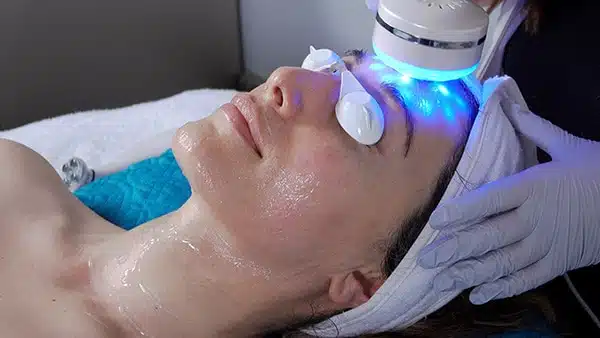 Acne LED Facial