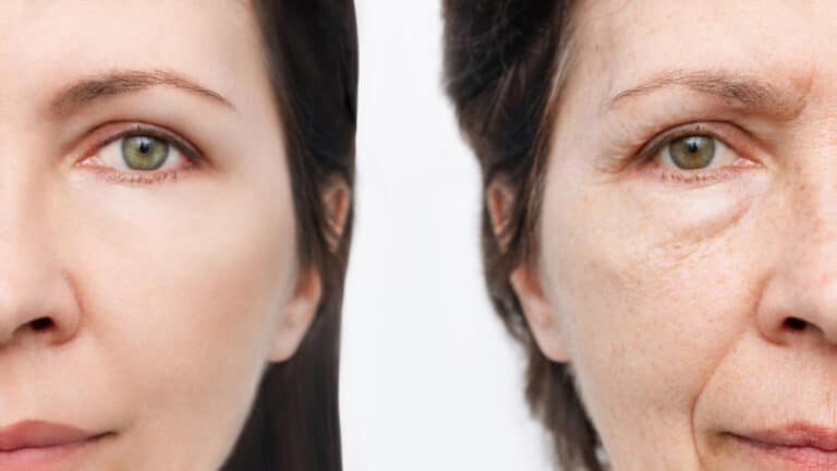 comparison face young aged women youth old age process aging rejuvenation