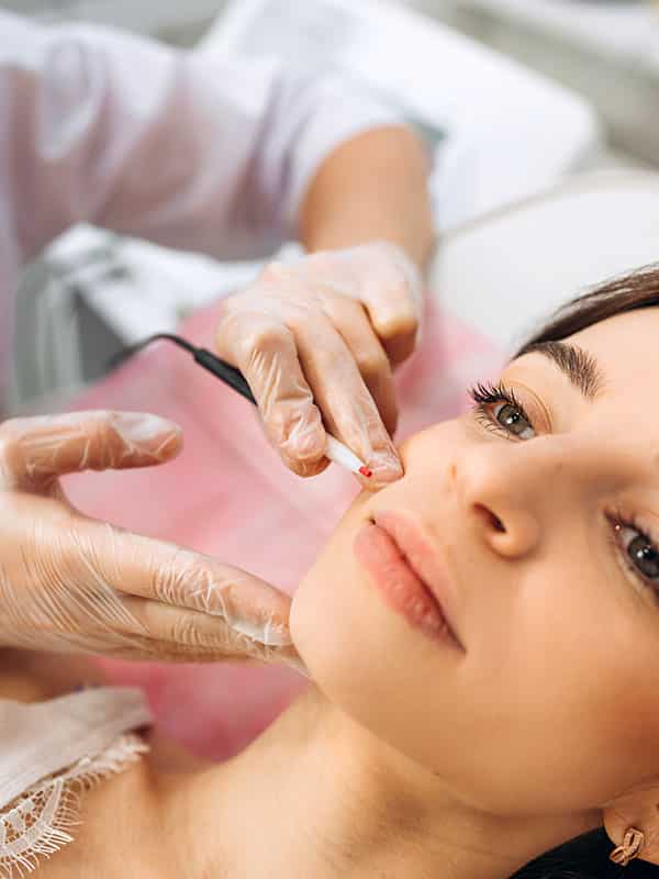 Electrolysis Facial Treatment by Skin Apeel Day Spa