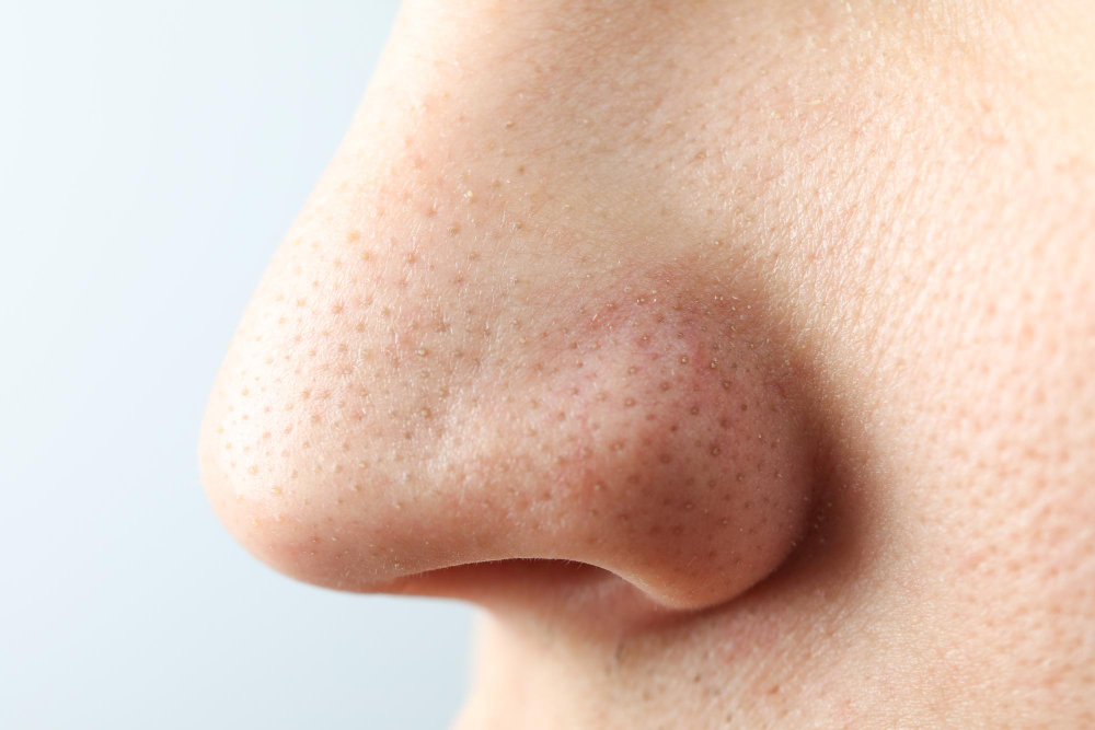 Top Products to Treat and Prevent Large Pores