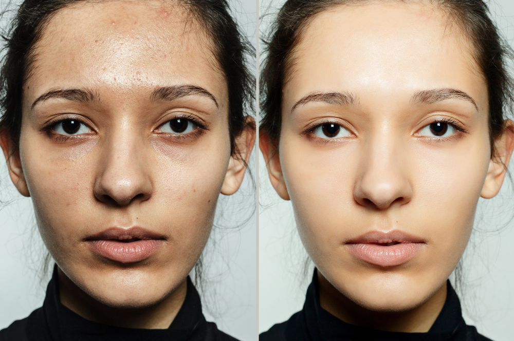 When Should You Consider an Organic Brightening Facial?